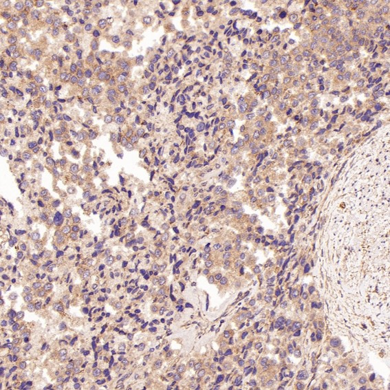 2 - Anti-Bim BCL2L11 Rabbit Monoclonal Antibody ABO13236