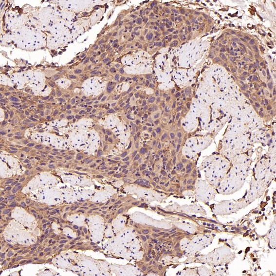 2 - Anti-Bim BCL2L11 Rabbit Monoclonal Antibody ABO13236