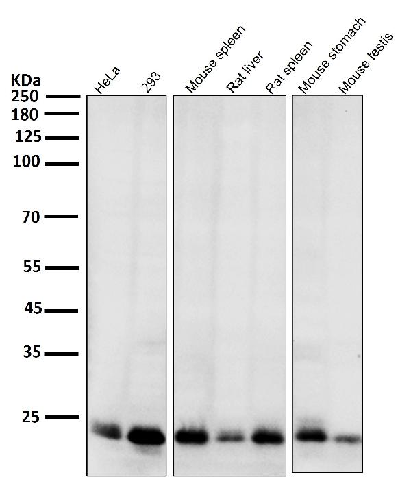 1 - Anti-Bim BCL2L11 Rabbit Monoclonal Antibody ABO13236