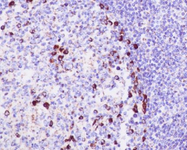 2 - Anti-CD9 Rabbit Monoclonal Antibody ABO13238