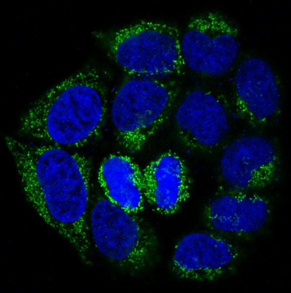 3 - Anti-Bad Rabbit Monoclonal Antibody ABO13239