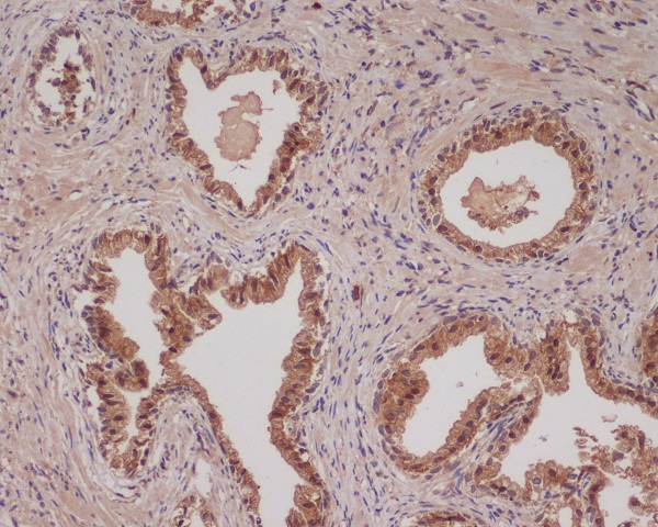 2 - Anti-Bad Rabbit Monoclonal Antibody ABO13239