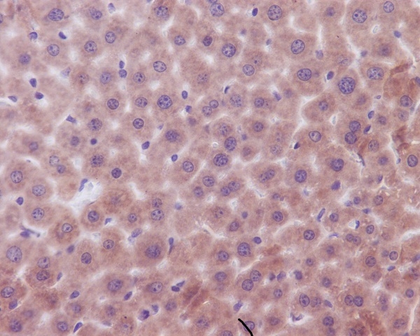 2 - Anti-Bak BAK1 Rabbit Monoclonal Antibody ABO13240