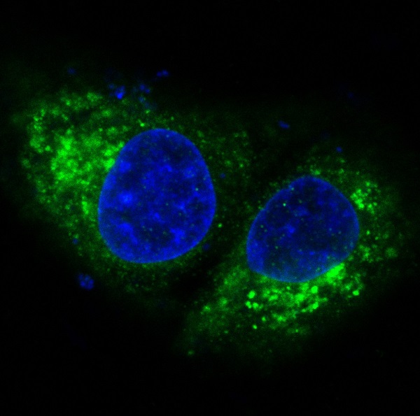 3 - Anti-Bak BAK1 Rabbit Monoclonal Antibody ABO13240