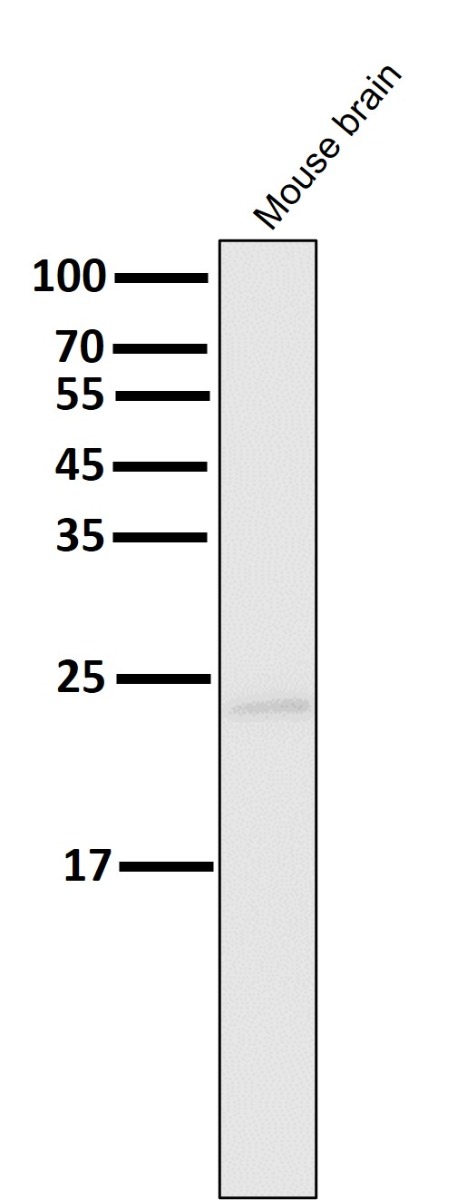 1 - Anti-Bak BAK1 Rabbit Monoclonal Antibody ABO13240