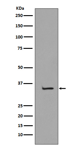 1 - Anti-TBP/Tata Binding Protein Tbp Rabbit Monoclonal Antibody ABO13241