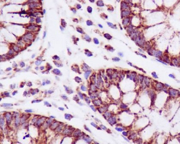 2 - Anti-PBR TSPO Rabbit Monoclonal Antibody ABO13242