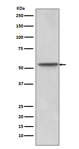 1 - Anti-Src Rabbit Monoclonal Antibody ABO13244