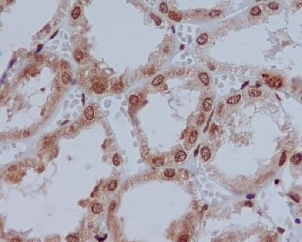 2 - Anti-YB1 YBX1 Rabbit Monoclonal Antibody ABO13245