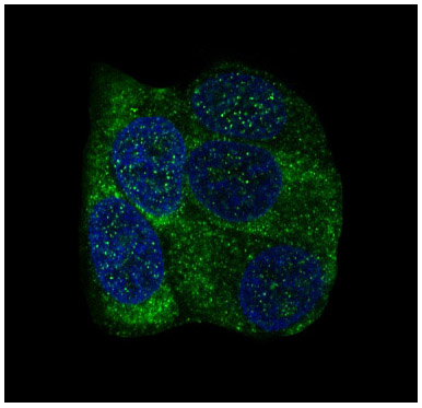 3 - Anti-YB1 YBX1 Rabbit Monoclonal Antibody ABO13245