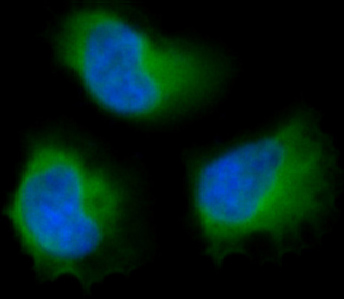 3 - Anti-FAK PTK2 Rabbit Monoclonal Antibody ABO13246