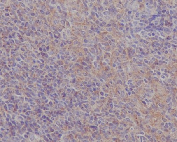 2 - Anti-FAK PTK2 Rabbit Monoclonal Antibody ABO13246