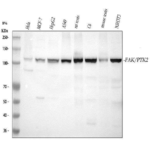 1 - Anti-FAK PTK2 Rabbit Monoclonal Antibody ABO13246