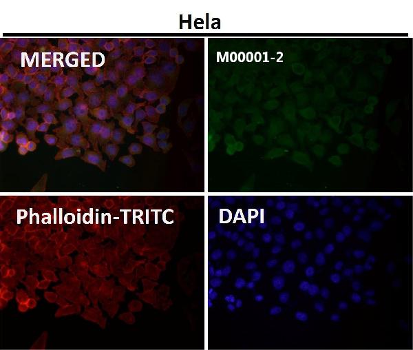 1 - Anti-p53 TP53 Rabbit Monoclonal Antibody ABO13247