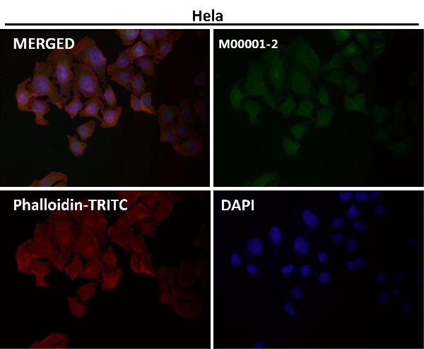 1 - Anti-p53 TP53 Rabbit Monoclonal Antibody ABO13247