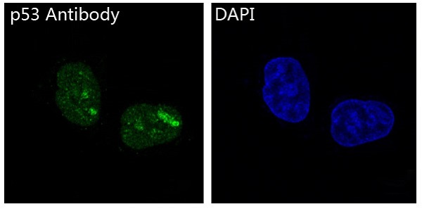 3 - Anti-p53 TP53 Rabbit Monoclonal Antibody ABO13247