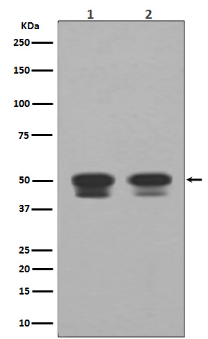 1 - Anti-p53 TP53 Rabbit Monoclonal Antibody ABO13247