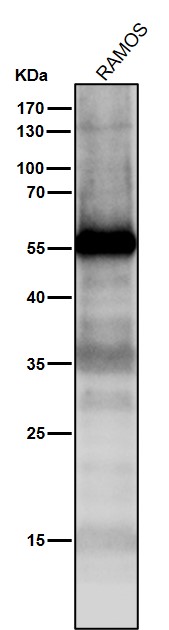 1 - Anti-p53 TP53 Rabbit Monoclonal Antibody ABO13247