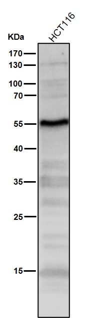1 - Anti-p53 TP53 Rabbit Monoclonal Antibody ABO13247