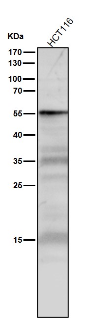 1 - Anti-p53 TP53 Rabbit Monoclonal Antibody ABO13247