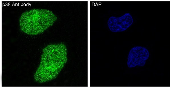 3 - Anti-p38 MAPK14 Rabbit Monoclonal Antibody ABO13248