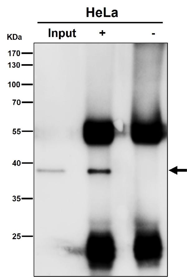 1 - Anti-p38 MAPK14 Rabbit Monoclonal Antibody ABO13248