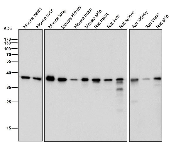 1 - Anti-p38 MAPK14 Rabbit Monoclonal Antibody ABO13248