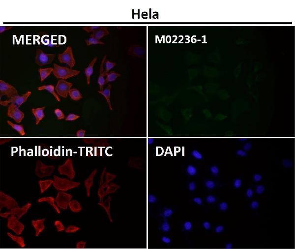 1 - Anti-CD8 CD8A Rabbit Monoclonal Antibody ABO13249