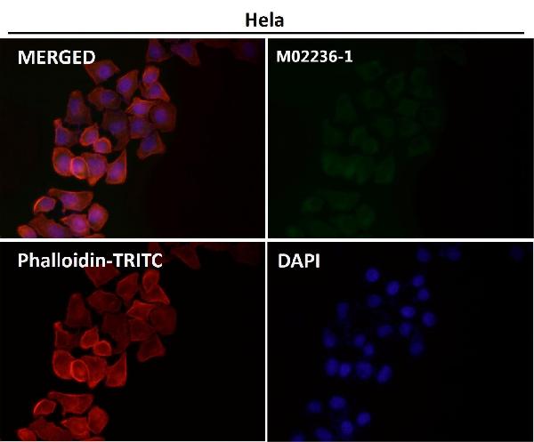 1 - Anti-CD8 CD8A Rabbit Monoclonal Antibody ABO13249