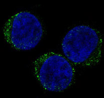 3 - Anti-CD8 CD8A Rabbit Monoclonal Antibody ABO13249