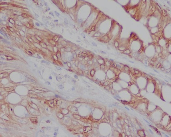 2 - Anti-CD8 CD8A Rabbit Monoclonal Antibody ABO13249