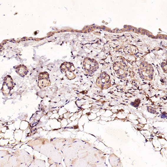 2 - Anti-CD8 CD8A Rabbit Monoclonal Antibody ABO13249