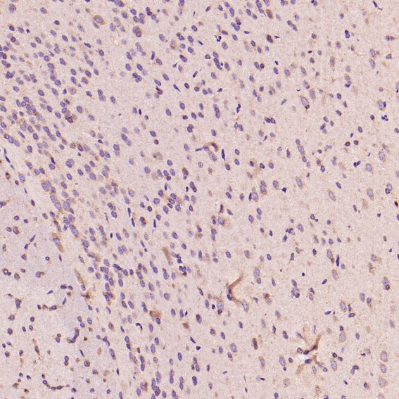 2 - Anti-CD8 CD8A Rabbit Monoclonal Antibody ABO13249