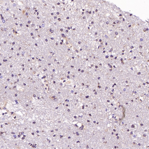 2 - Anti-CD8 CD8A Rabbit Monoclonal Antibody ABO13249