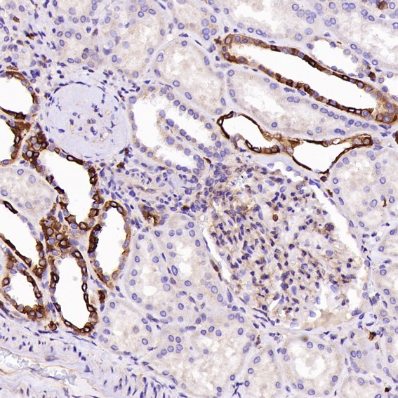 2 - Anti-CD8 CD8A Rabbit Monoclonal Antibody ABO13249