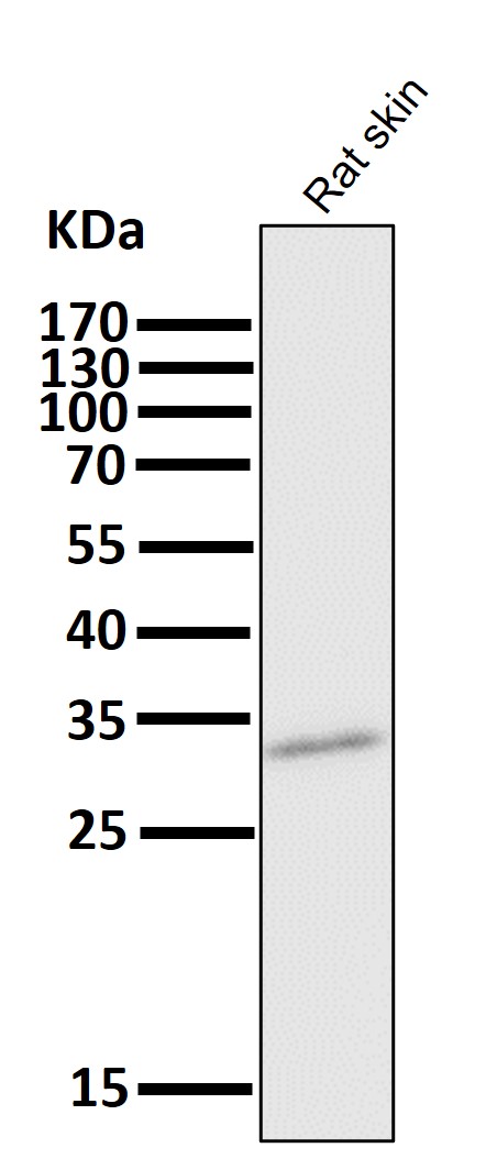 1 - Anti-CD8 CD8A Rabbit Monoclonal Antibody ABO13249