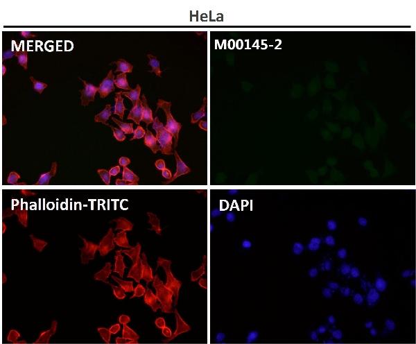 1 - Anti-p21 CDKN1A Rabbit Monoclonal Antibody ABO13250