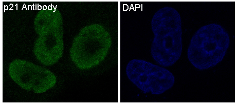 3 - Anti-p21 CDKN1A Rabbit Monoclonal Antibody ABO13250