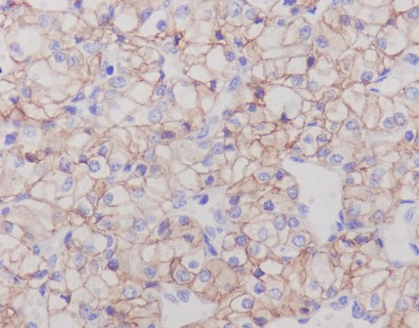 2 - Anti-CA9/Ca Ix Rabbit Monoclonal Antibody ABO13251