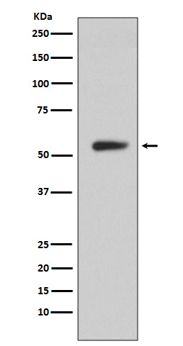 1 - Anti-CA9/Ca Ix Rabbit Monoclonal Antibody ABO13251