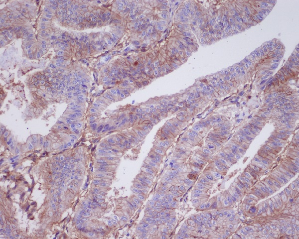 2 - Anti-5T4 TPBG Rabbit Monoclonal Antibody ABO13252