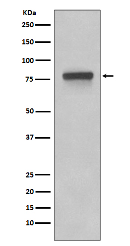 1 - Anti-5T4 TPBG Rabbit Monoclonal Antibody ABO13252