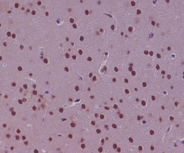 2 - Anti-p73 Rabbit Monoclonal Antibody ABO13253