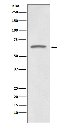 1 - Anti-p73 Rabbit Monoclonal Antibody ABO13253