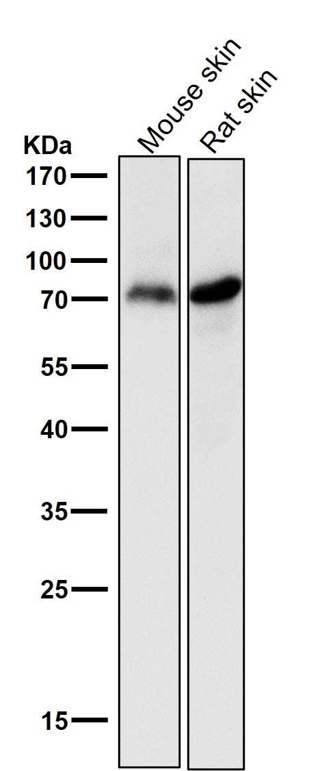 1 - Anti-p73 Rabbit Monoclonal Antibody ABO13253