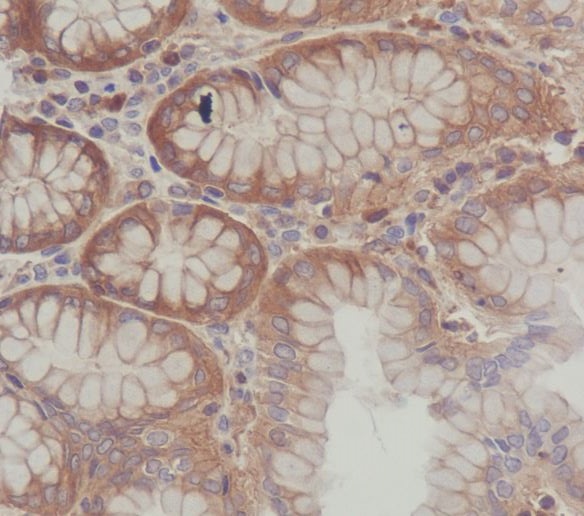 2 - Anti-SCF Rabbit Monoclonal Antibody ABO13254