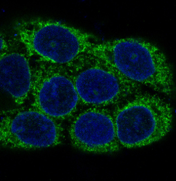3 - Anti-NSE ENO2 Rabbit Monoclonal Antibody ABO13255