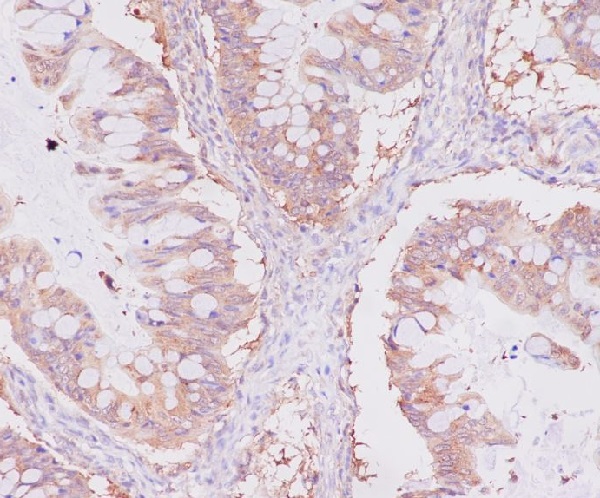 2 - Anti-NSE ENO2 Rabbit Monoclonal Antibody ABO13255