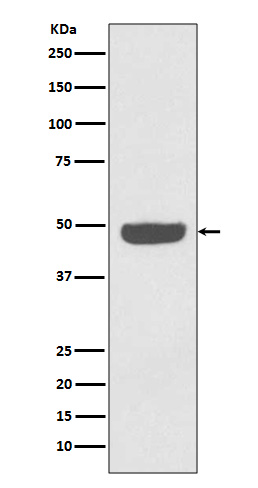 1 - Anti-NSE ENO2 Rabbit Monoclonal Antibody ABO13255