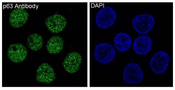 3 - Anti-p63 TP63 Rabbit Monoclonal Antibody ABO13256